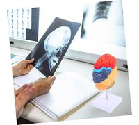Cabilock Human Brain Anatomical Model Half Brain Educational Display with Removable Parts Teaching Instrument for Medical Students and Neuroanatomy Learning