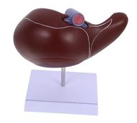 Cabilock Medical Liver Teaching Model with Base Human Anatomical Liver Model for Education and Realistic Organ Anatomy Display for Students and Medical Professionals