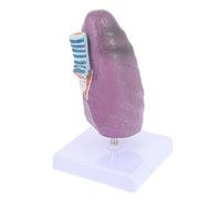 Cabilock Pathological Lung Model Smoking Lung Anatomy Teaching Aid for Realistic Respiratory Structure for Schools and Training Institutions and Practical