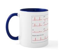 CafePress Ecgs of A Normal Heart Rate, Artwork Mug 11 oz (325 ml) Ceramic Coffee Mug