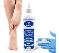 Callus Remover for Feet - Original, Powerful Formulation - Extra Strength Gel, Home Pedicure Foot Spa Results - Cracked & Dead Dry Skin Supplies -