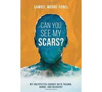Can You See My Scars?: My Unexpected Journey With Trauma, Burns, and Recovery