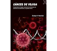 Cáncer de vejiga: Comprender el riesgo, reconocer los síntomas, las opciones de tratamiento y la gestión eficaz