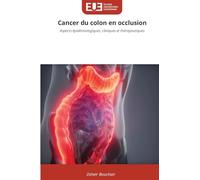 Cancer du colon en occlusion: Aspects épidémiologiques, cliniques et thérapeutiques