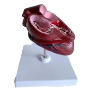 Canine Heart Heartworm Anatomical Model with Base Dog Pathology Study Teaching Aid, Ventricles Blood Vessels for Veterinary Science Education, Demonstration Tool Vet Training and Classroom