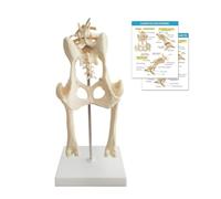 Canine Pelvis Model, Normal and Osteoarthritic Hip Joint Bones for Anatomy, Physiology Education, Anatomy Model for Veterinarian’s Offices and Classrooms, Medical Learning Resources