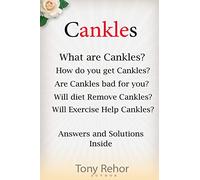 Cankles: This Guide will answer all of your Cankles questions