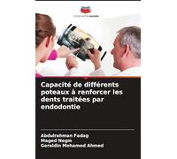 Capacité de différents poteaux à renforcer les dents traitées par endodontie