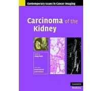 Carcinoma of the Kidney (Contemporary Issues in Cancer Imaging)
