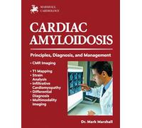 CARDIAC AMYLOIDOSIS: PRINCIPLES, DIAGNOSIS, AND MANAGEMENT
