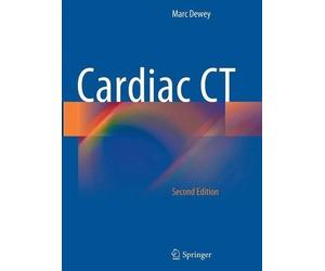 Cardiac CT by Marc Dewey - 9783662506561
