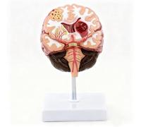Cardiovascular and Cerebrovascular Brain Model for the Elderly with Base丨Detachable Realistic Human Pathological Brain Model, Vibrant Colors, Neurology Classroom Teaching Aid for Anatomy Training