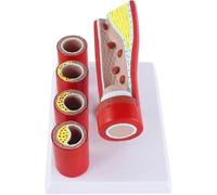 Cardiovascular Artery Coronary Artery-Like Model Human Teaching Pathological Vascular Anatomical Model -Aged Branch Artery Sclerosis Formation Thrombosis Model - Study Model Coronary