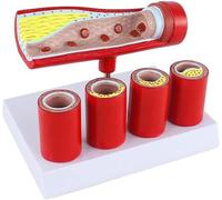 Cardiovascular Artery Model - Coronary Artery-Like Anatomical for Teaching Pathology and Sclerosis Formation