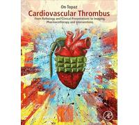 Cardiovascular Thrombus: From Pathology and Clinical Presentations to Imaging, Pharmacotherapy and Interventions