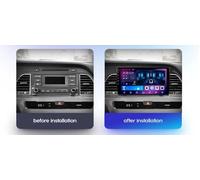 Carplay Screen for Hyundai Sonata 7 LF 2014-2017 Hd Touch Screen Car Stereo Portable Live Car Play Music Video Player Siri/Aux/Airplay/Fm/Radio, 4 Core 4G+64G