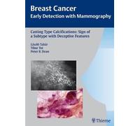 Casting Type Calcifications: Sign of a Subtype with Deceptive Features: v. 2 (Breast Cancer - Early Detection with Mammography): Sign of a Subtype With Unpredictable Outcome (Tabar Mammo)