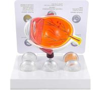 Cataract Eye Model, Eye Anatomy Model, with Explanatory Card, Demonstration of 5 Pathological States, Human Eye Anatomical Model, for Science Education, Students Study