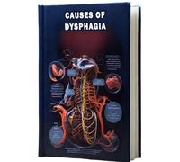 Causes of Dysphagia: Understand the causes of dysphagia, a condition characterized by difficulty in swallowing, and its impact on daily life.