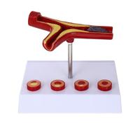 CAXUSD Realistic Pvc Cardiovascular Teaching Model for Human Blood Vessel Anatomy, Educational Heart Display Model Suitable for Anatomy and Physiology Teaching, for Students