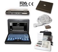 CE Approved Digital Ultrasound Scanner Portable Laptop Machine,7.5m Linear Probe