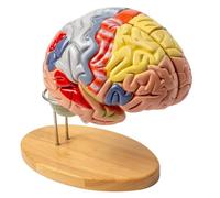 Cerebral Vascular Model - 2X Magnification of Human Brain Anatomy, Cerebral Appendage and Artery Model for Neurology Education