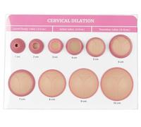 Cervical Dilation Simulator with 1-10cm, Cervical Dilation Model, Gynecological Education Teaching Model, for Midwife and Doula Training, Medical Education and Birth Learning