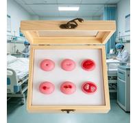 Cervical Pathology Model Set, 6-Stage Uterus and Cervix Anatomy Model for Training and Patient Education, Includes Multi-lesion Features and Wooden Box