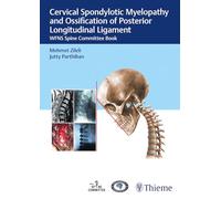 Cervical Spondylotic Myelopathy and Ossification of Posterior Longitudinal Ligament: WFNS Spine Committee Book