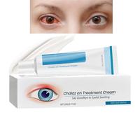 Chala/zion&Blep/haritis Treatment Eye Cream,Soothing Relief for Swollen Eyelids,Chala/zion Treatment for Stye,Moisturising Cream for Dark Circles&Puffiness,Dry Eyes Treatment,Eye Stye Treatment