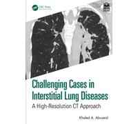 Challenging Cases in Interstitial Lung Diseases : A High-Resolution CT Approach