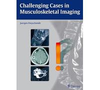 Challenging Cases in Musculoskeletal Imaging