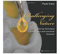 Challenging Nature: Wax-up Techniques in Aesthetics and Functional Occlusion