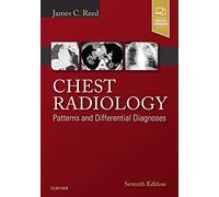 Chest Radiology: Patterns and Differential Diagnoses