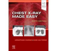 Chest X-Ray Made Easy