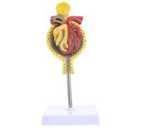 CHICAMPERA Anatomical Environmental-friendly Model Human Normal Glomerulus Pvc Model with Base Design for Teaching and Display