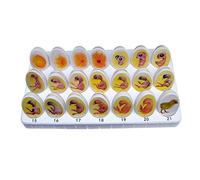 Chick Embryo Growth Model - Medical Anatomical Chick Embryo Model - Biological Teaching Model Of Egg-Brood Development Process - For The Studies That
