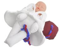 Childbirth Education Pelvis Model with Detachable Placenta Permanent Clinical School Teaching Aid for Gestational Courses Placental Pelvic Model for Education