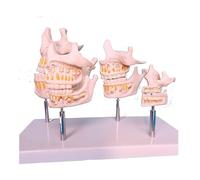 Children's Dental Development Model - Bionic Tooth Anatomy Teaching Tool for Oral Care Education and Jaw Growth Demonstration