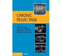 Chronic Pelvic Pain