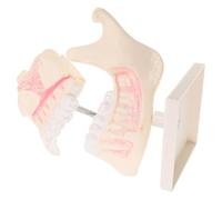 Ciieeo Realistic Teeth Model for Students High-simulation Plastic Typodont for Pre-clinical Practice Oral Hygiene Education and Skill Development in Study