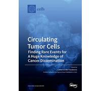 Circulating Tumor Cells: Finding Rare Events for A Huge Knowledge of Cancer Dissemination