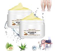 Circulheal Varicose Veins Miracle Cream-Vitamin K Cream,Varicose Vein Miracle Cream,Varicose Veins Treatment Cream,Varicose Veins Cream Relief,Rejuvenates and Improves Blood Circulation (2 Pcs)