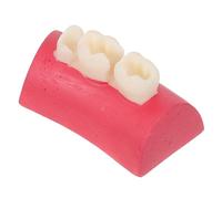 CIYODO Root Canal Preparation Model for Dental Filling Practice, Plastic Simulation Model with Training Advancement and Effortless Maintenance, for Rct Training Aid and Independent