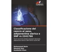 Classificazione del cancro al seno, adiponectina sierica e SNP rs 2241766: Tipi di carcinoma duttale mammario femminile, adiponectina sierica e SNP 45T/G rs2241766