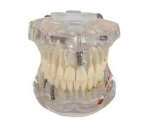 Clear Dental Jaw Model for Dentist Office and Educational Anatomy Training