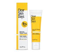 Clear Skin Days Blemish Treatment Cream - Overnight Spot & Acne Treatment for Face - with Salicylic Acid & Zinc - Calm Aggravated Skin, Treat Blemishes & Acne 30ml