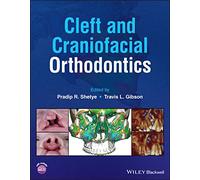 Cleft and Craniofacial Orthodontics