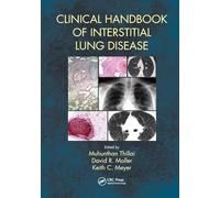 Clinical Handbook of Interstitial Lung Disease
