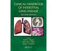 Clinical Handbook of Interstitial Lung Disease